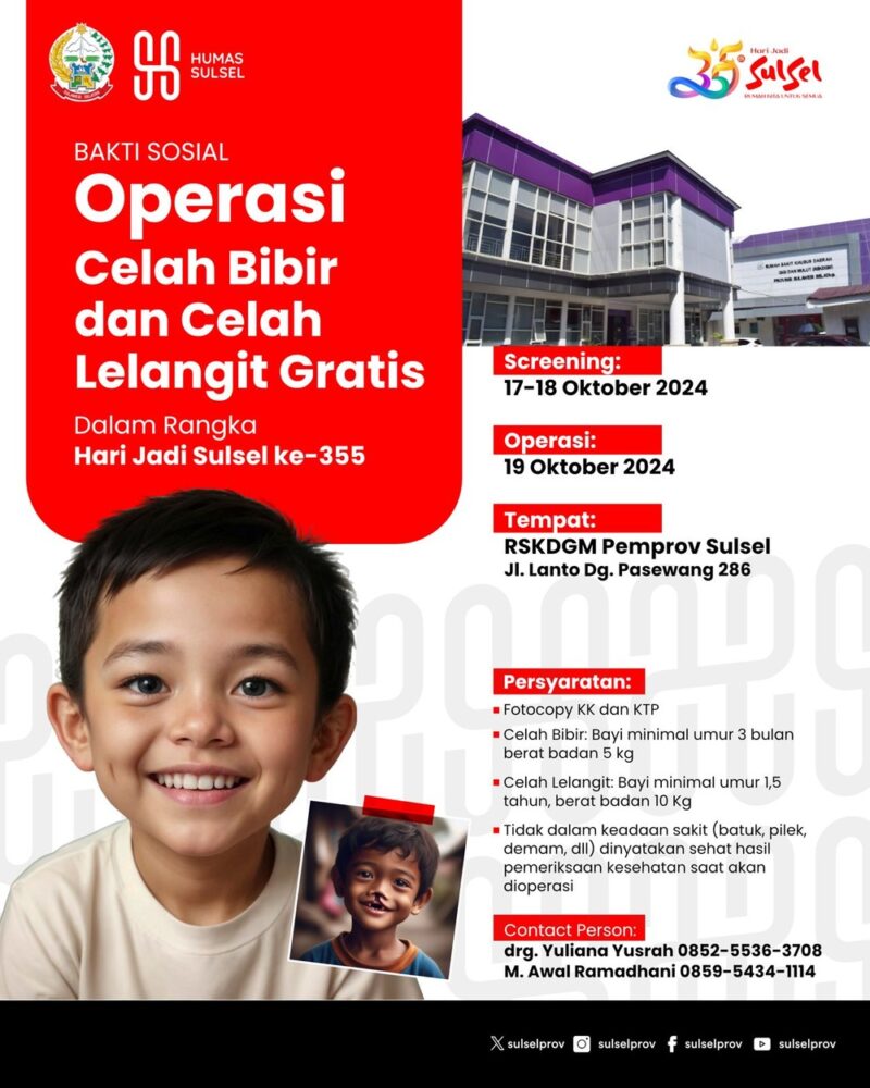 Pemerintah Provinsi Sulawesi Selatan (Sulsel) akan menggelar bakti sosial operasi celah bibir dan celah lelangit secara gratis di Rumah Sakit Khusus Daerah Gigi dan Mulut (RSKDGM) Provinsi Sulsel, Jalan Lanto Dg. Pasewang No. 286, Makassar. Kegiatan ini merupakan rangkaian peringatan menyambut Hari Ulang Tahun (HUT) ke-355 Sulawesi Selatan. 